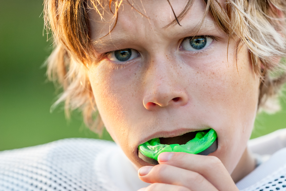 Ask Your Dallas Dentist: Sports Mouth Guards